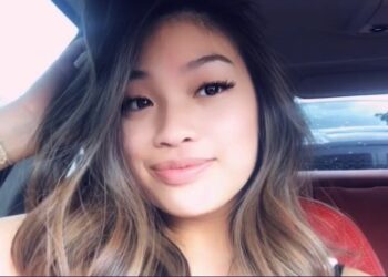 한인의사에게 성형수술 10대소녀, 코마상태 14개월만에 사망