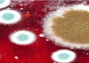 FDA,  “블루베리 요거트 일부 제품 곰팡이” 리콜