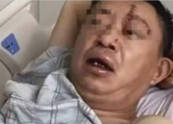 ‘무차별 폭행’ 뇌출혈 40대 남성, 5일만에 의식 회복