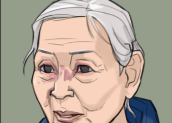 80대 한인 할머니 ‘묻지마 폭행’ 피해