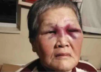 혐오폭행 맞섰던 할머니, 성금 100만달러 기부키로