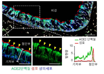 “코로나 감염, 호흡기 아닌 코에서 시작” 첫 규명