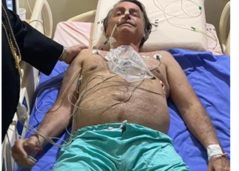 10일째 딸꾹질 멈추지 않는 대통령..수술도 검토 