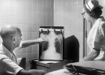 결핵, 코로나처럼 숨 내쉴 때 전염…기침전파 통념 깨져