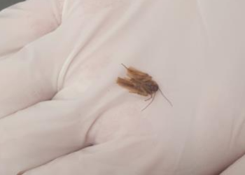 “내 귀에 바퀴벌레가”…3일 만에 찾아 꺼냈다