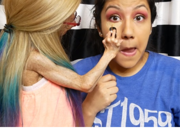 조로증 앓던 미 소녀(사진 왼쪽) 15세 일기로 사망