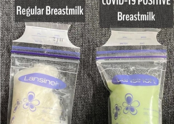 코로나 감염 후 모유 녹색으로…”항체 때문이라 생각..아기에게 먹여”