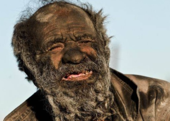 67년 안씻고, 동물사체 먹은 87세남성, 건강상태 보니?