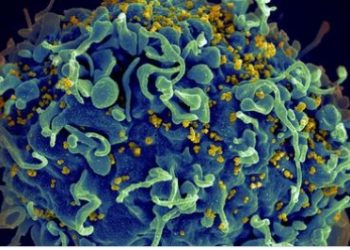 UCLA 연구팀, 줄기세포로 백혈병·HIV 치료 성공