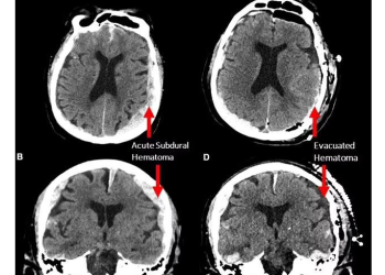 “죽기 직전 지난 삶 주마등처럼 지나간다” 사실 확인