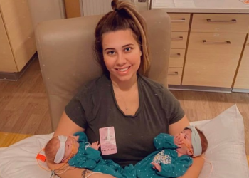 바나나 3개 무게 쌍둥이 미숙아…22주차 3일 간격 출산