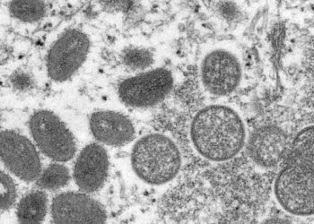 미국서 멍키팍스(원숭이두창) 감염 확인..북미, 호주, 유럽 등서 확산