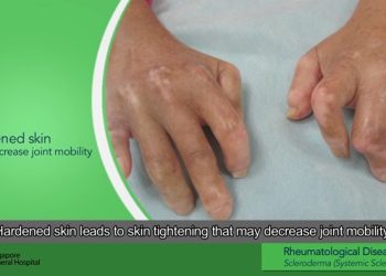 [화제]”피부병 때문에” 양손 이식 수술..세계 최초