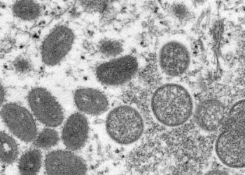 “멍키팍스, 동물 아닌 사람에게서 전파됐다”