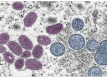 멍키팍스 공기 전파 가능성 대두