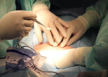 텍사스 4살 남자아이 탈장 수술 중 정관 절제돼…부모, 병원 고소