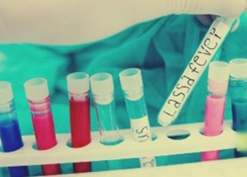 나이지리아에서 라싸출혈열로 155명 사망