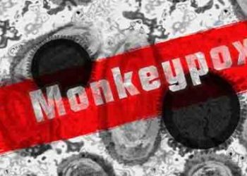 멍키팍스, 4주만에 28개국 898명…3가지 리스크는?