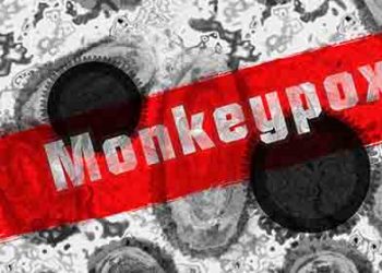 LA 카운티에서 벌써 4번째 몽키팍스 환자 발생