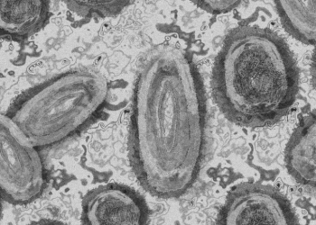 커지는 몽키팍스 공포…미국, 검사 2배 확대..민간업체 검사 본격