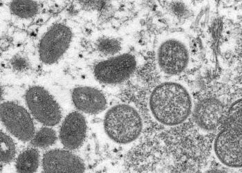 브라질, 스페인서 멍키팍스 사망자 발생..아프리아 이외지역 처음