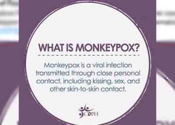 멍키팍스 확산…패사디나서  몽키팍스 감염자 첫 확인