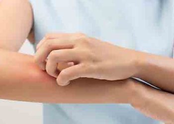 “긁다가 한숨도 못잤다”…’피부악당’ 가려움증 퇴치법