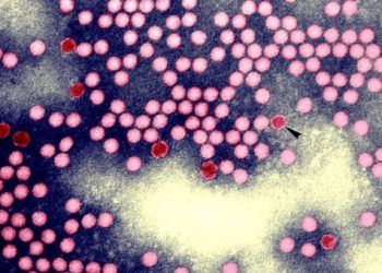 뉴욕주, 소아마비 비상사태 선포…폐수에서 바이러스 발견