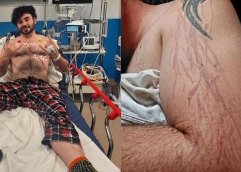 억세게 운 없는 남성, 자기 집 거실서 벼락 맞아