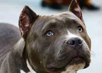 “우리 개는 안물어요” 8살 아이 핏불에 얼굴 물려 중태