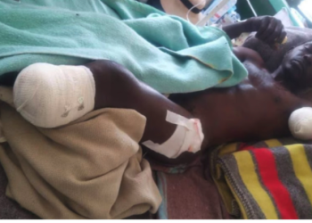 코끼리떼 피하려다가 악어 만난 억세게 운나쁜 남성