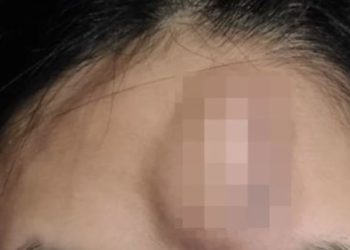 소개팅 여성이 더치페이 거부하자 폭행