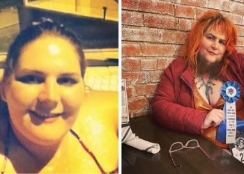 하루에 두번씩 면도하며 감추기 ‘턱수염 여성’