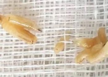 귀 통증으로 병원 간 남성…원인은 “살 파먹는 ×××”