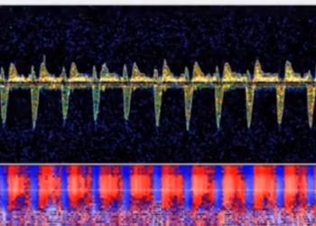 뇌사 판정 기준 새로 정해야…미국 논의 진행(영상)
