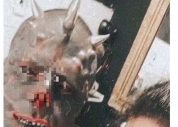 머리에 수십개 ‘뿔’ 이식한 ‘실사판 사탄’ 남성