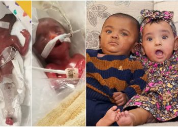 “생존확률 0%” 극복한 미숙아 쌍둥이