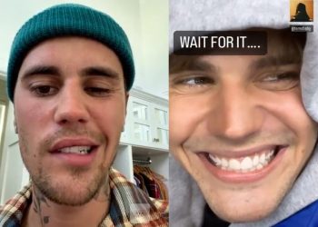 ‘안면마비’저스틴 비버, 미소 되찾았다.