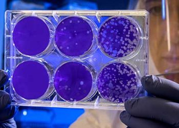 리버사이드 중학교서 폐결핵 감염자 발생..접촉자 20명