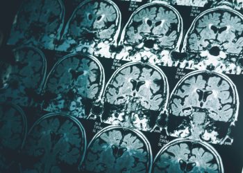 죽음은 복잡한 과정…”임박한 순간 뇌감마파 300배 폭발”