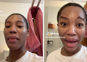 보톡스 맞다가…’나이키’ 눈썹 된 여성