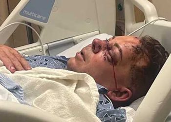 “롤렉스 시계 내놔” 무장강도 무차별 폭행 LA  보석상 중태