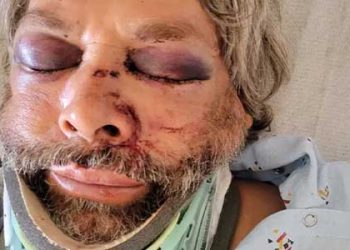 OC 도로 공사장 폭력 사태…노동자 집단 구타