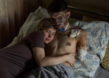 팔과 눈 모두 잃은 병사 사진 세계가 울었다