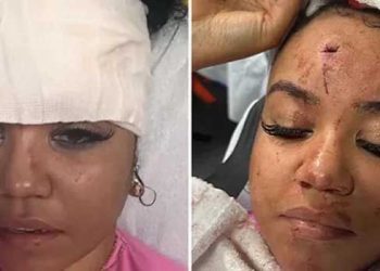 톱가수 공연 중 마이크 던져.. 피해여성 피범벅