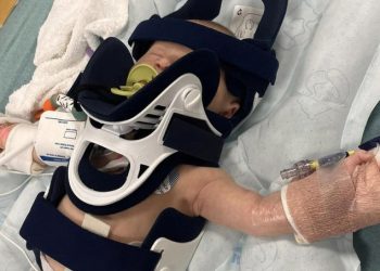 “3주 신생아랑 야구장”… 파울공에 두개골 골절