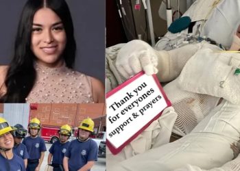 패사디나 소방관 지망 10대 소녀, 전신화상 중태