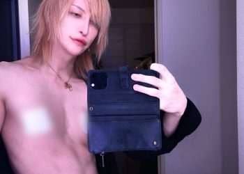 남성 기타리스트 젖꼭지 절제술 받아 “연주할 때 방해”