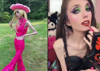 ‘안전 걱정된다’…39㎏ ‘뼈만 남은’ 유튜버, 팬들 신고