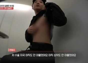 전청조, 가슴 절제 자국 공개…갑자기 상의 훌러덩